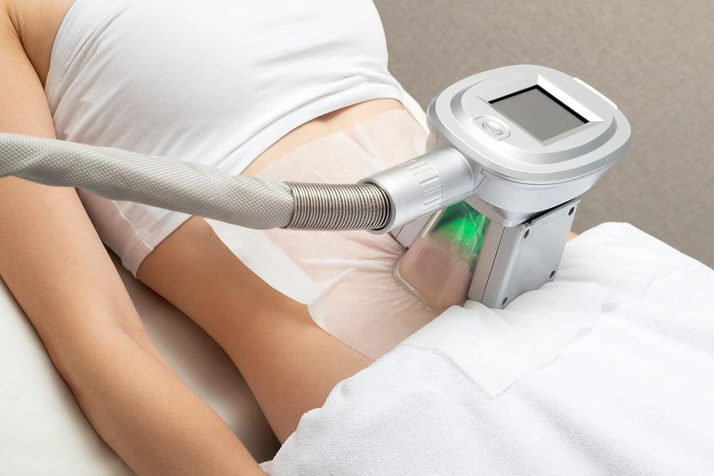 Fat Freezing — Cryolipolysis
