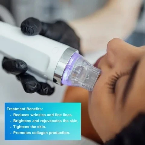 Golden RF Microneedling — Skin Renewal & Firming
