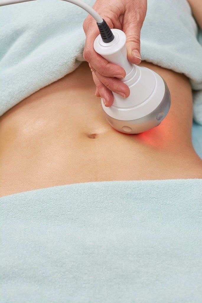 RF Body Treatment / Ultrasound Cavitation