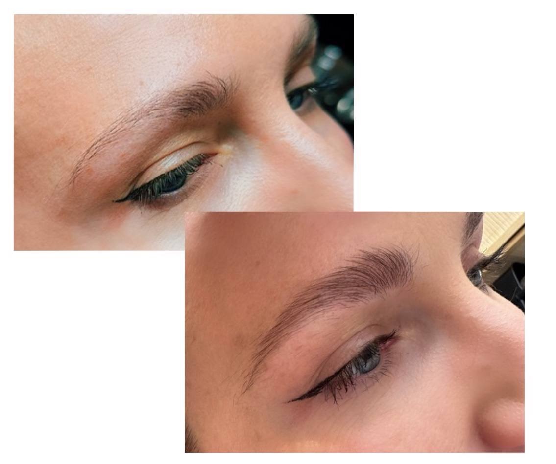 Brow Renewal Therapy — Microneedling for Brows