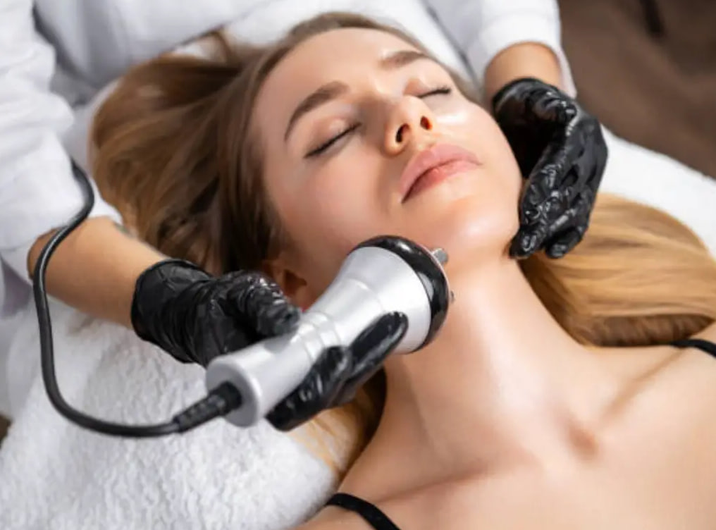 RF Lifting — Face & Neck