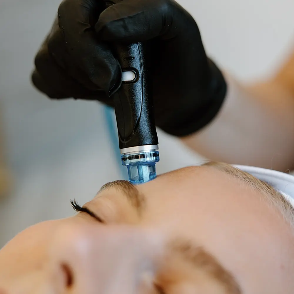 HydraFacial (Deep Glow)